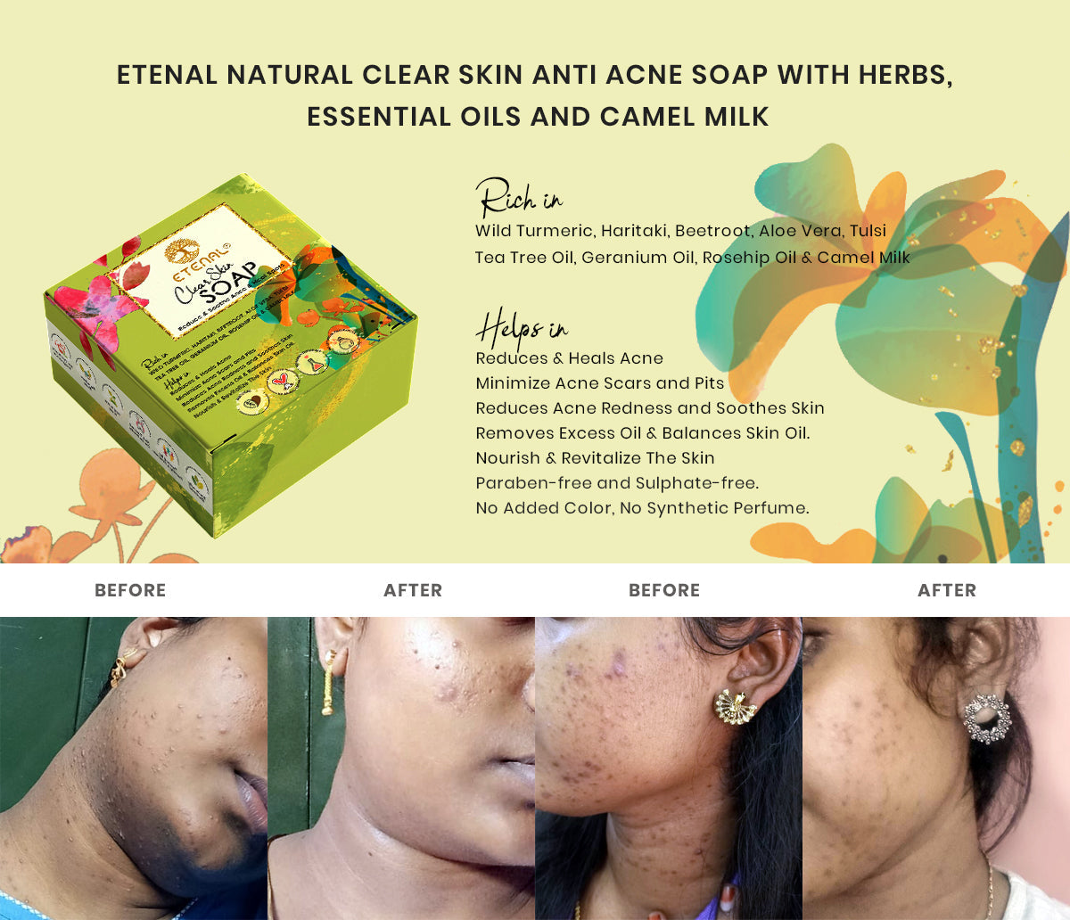 Etenal Clear Skin Natural Soap