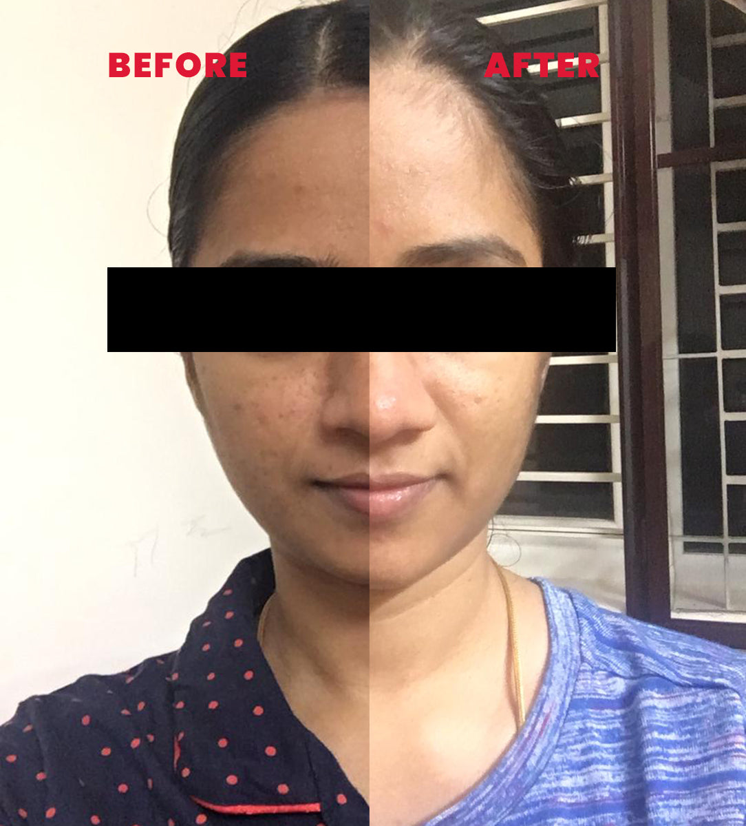 Etenal: The Original Kumkumadi Soap Ayurvedic Skin Brightening & Pink Glow Bathing Soap Bar