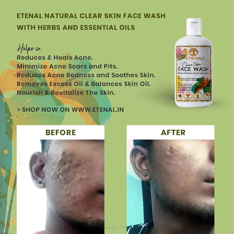 Etenal Clear Skin Face wash